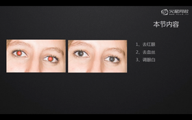 1分钟去眼袋眼纹